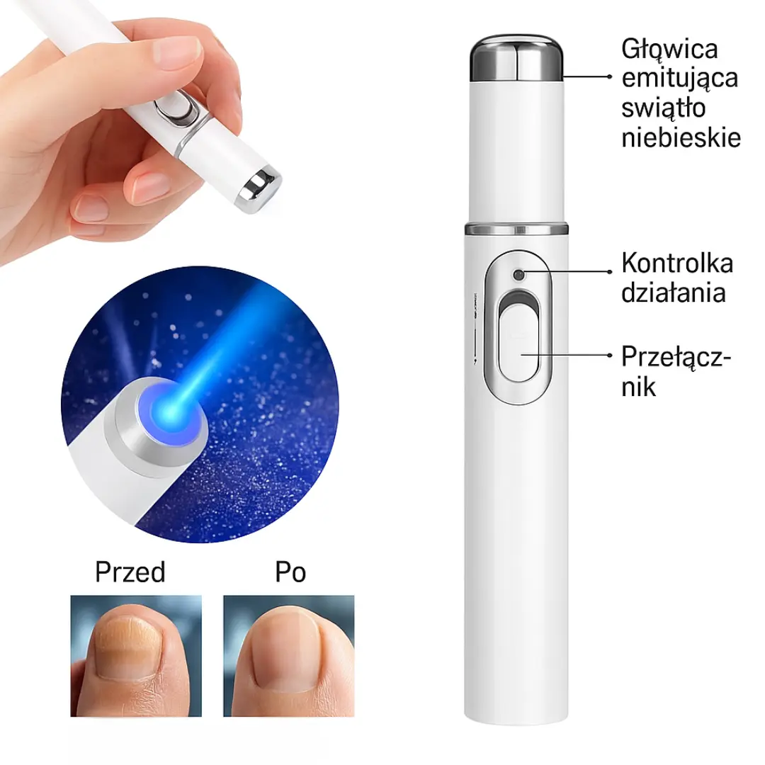 BluePoint™ - Wsparcie w Pielęgnacji Paznokci z Oznakami Grzybicy