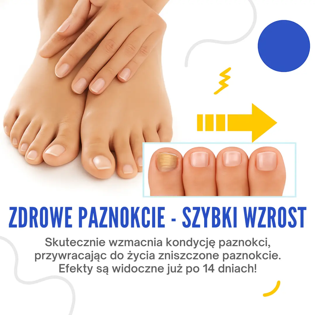 BluePoint™ - Wsparcie w Pielęgnacji Paznokci z Oznakami Grzybicy